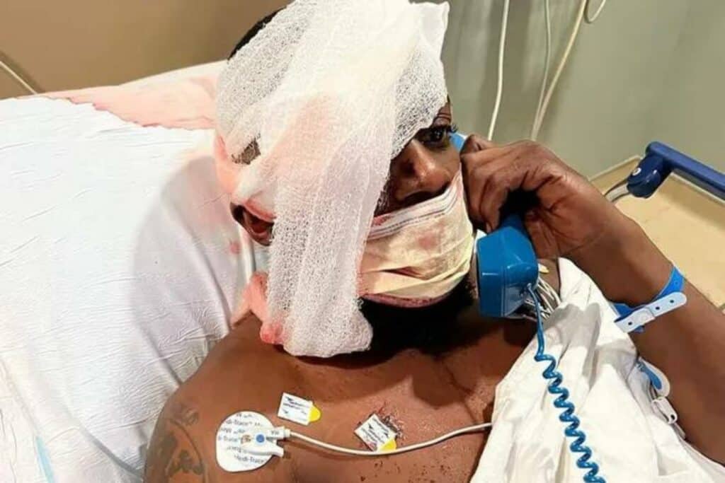 Terrell Bradley bandaged head in hospital