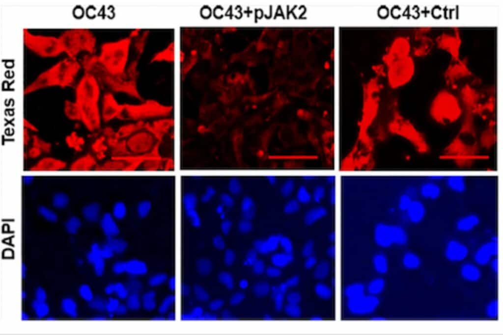 UF researchers find way to inhibit virus that causes COVID 19