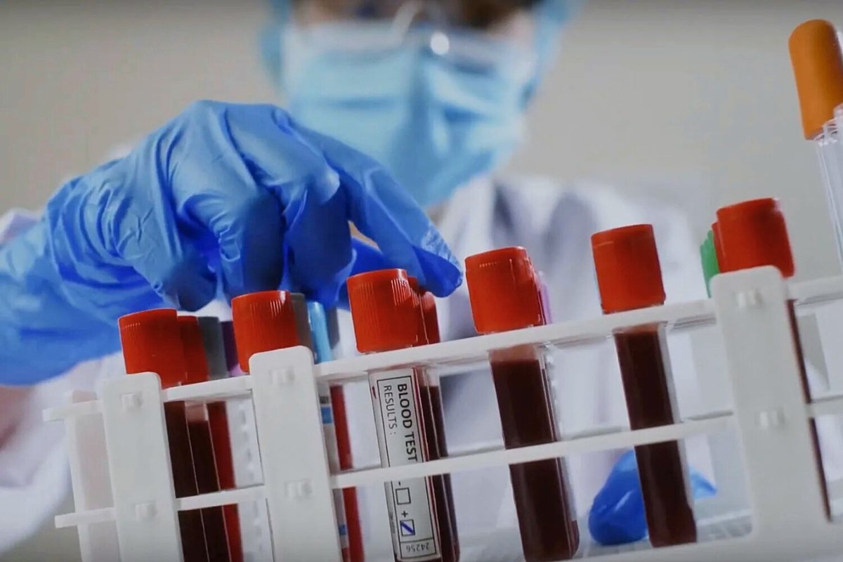 UF Health tests new blood management program