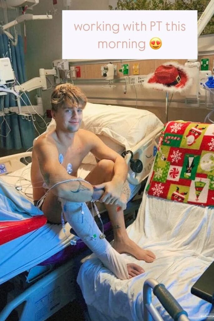 David Humphlett at UF Health Shands Hospital after being bitten by an eastern diamondback rattlesnake.