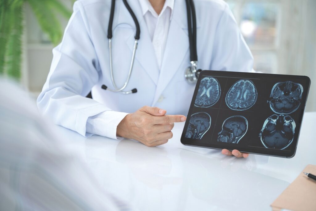 Doctor showing brain scan of Alzheimer's disease patient. Metro Creative